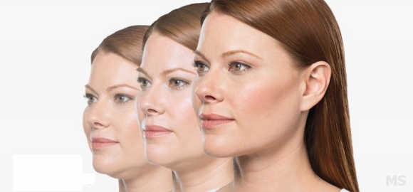 Double Chin Treatments at Milady Medical Spa Brooklyn NY 11235