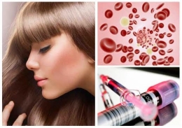 PRP Platelet Rich Plasma Hair Regrowth Restoration Therapy at Milady Medical Spa Brooklyn NY 11235