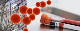 PRP Platelet Rich Plasma Hair Regrowth Restoration Therapy at Milady Medical Spa Brooklyn NY 11235
