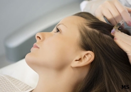 Hair Loss Treatment at Milady Medical Spa Brooklyn NY 11235