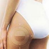 Endermologie2