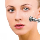Diamond Microdermabrasion Facial