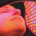 Cold Laser Facial