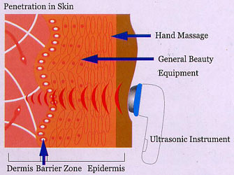 ultrasonic
