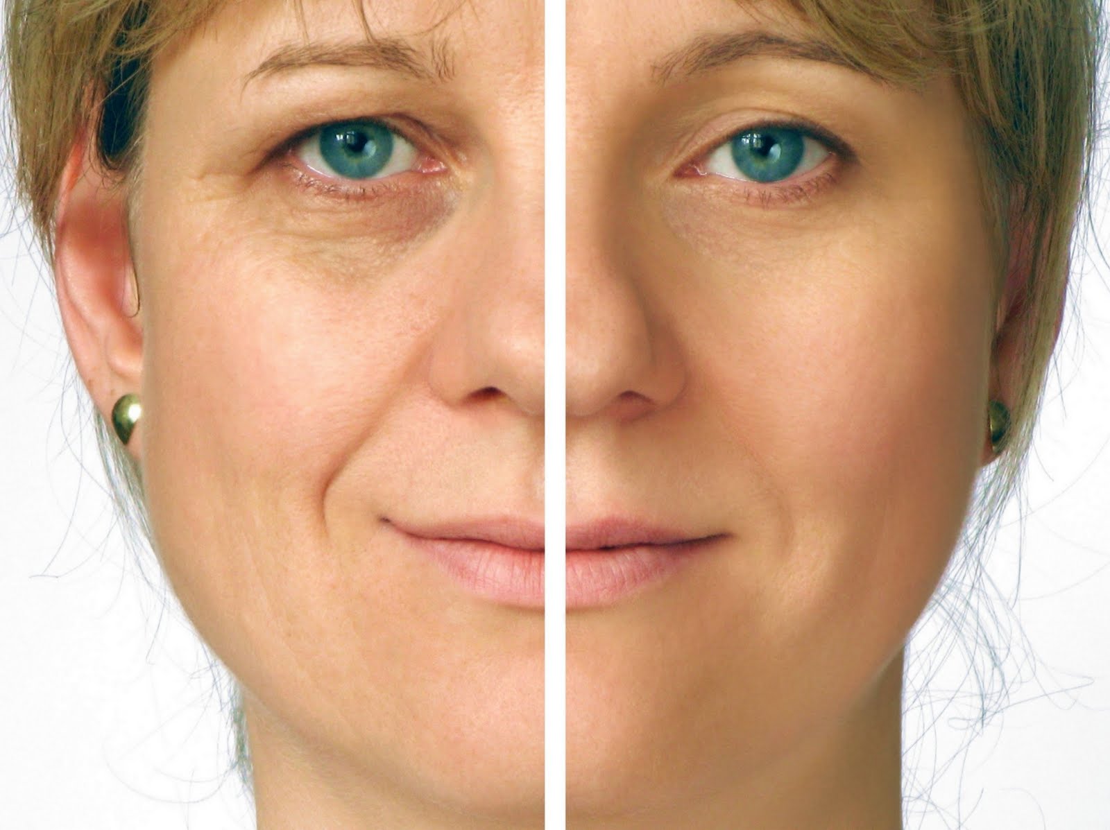 Microcurrent Lifting Facial