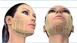 Ulthera Skin lifting at Milady Medical Spa Brooklyn NY 11235